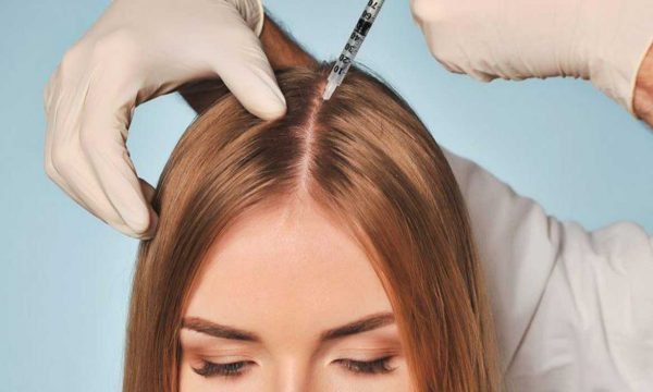 ابر الميزوثيرابي للشعر