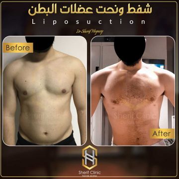 تجربتي مع نحت الجسم