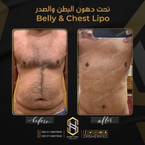 النحت الديناميكي للجسم