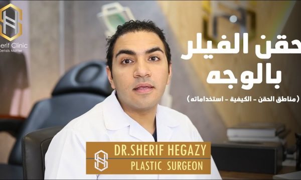 فيلر الوجه