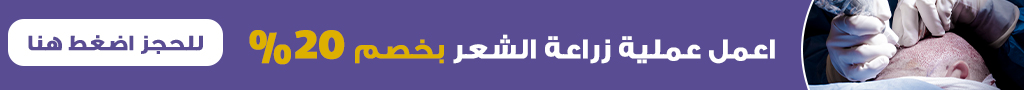 عروض زراعة الشعر