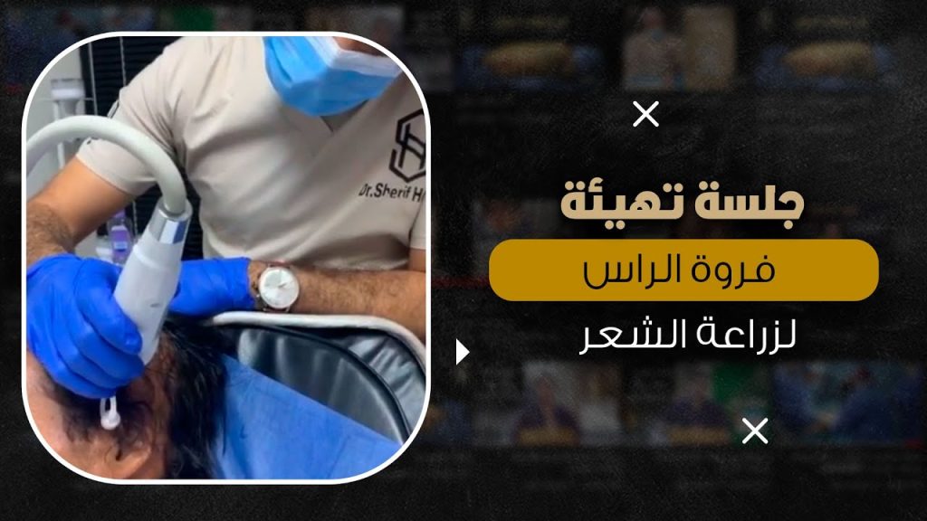 جلسة تهيئة فروة الرأس لزراعة الشعر