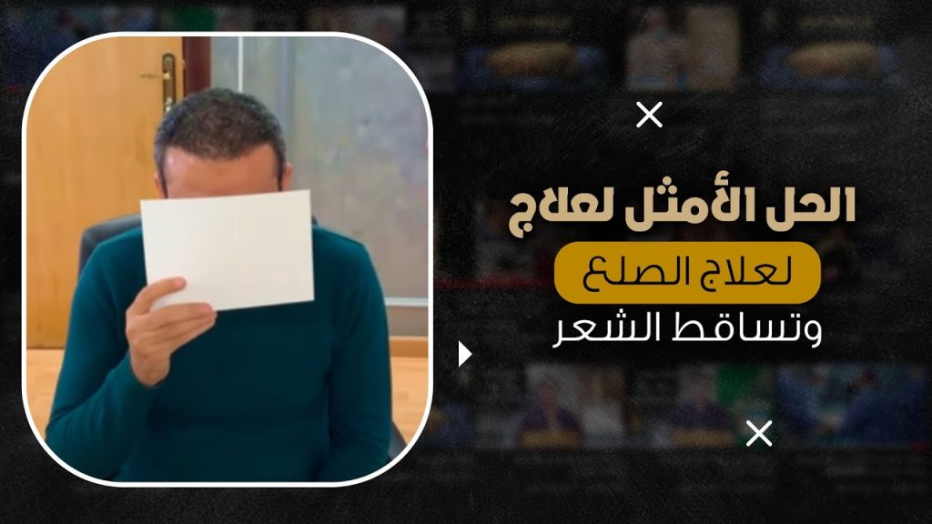 الحل الأمثل لعلاج الصلع وتساقط الشعر
