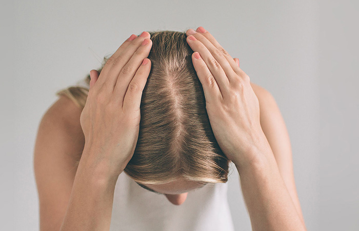 زراعة الشعر للسيدات